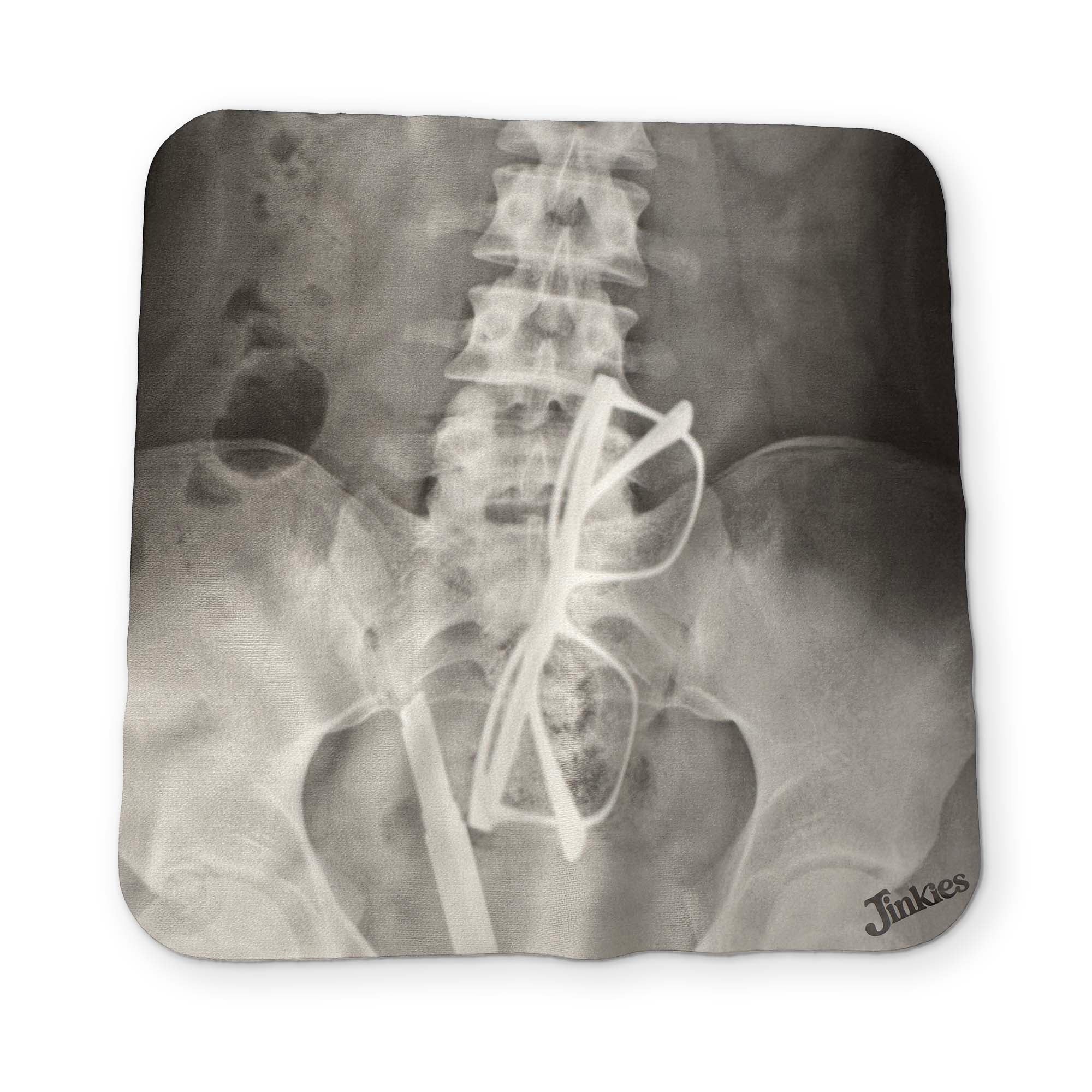 AN  X-RAY YOU CAN CLEAN YOUR GLASSES WITH