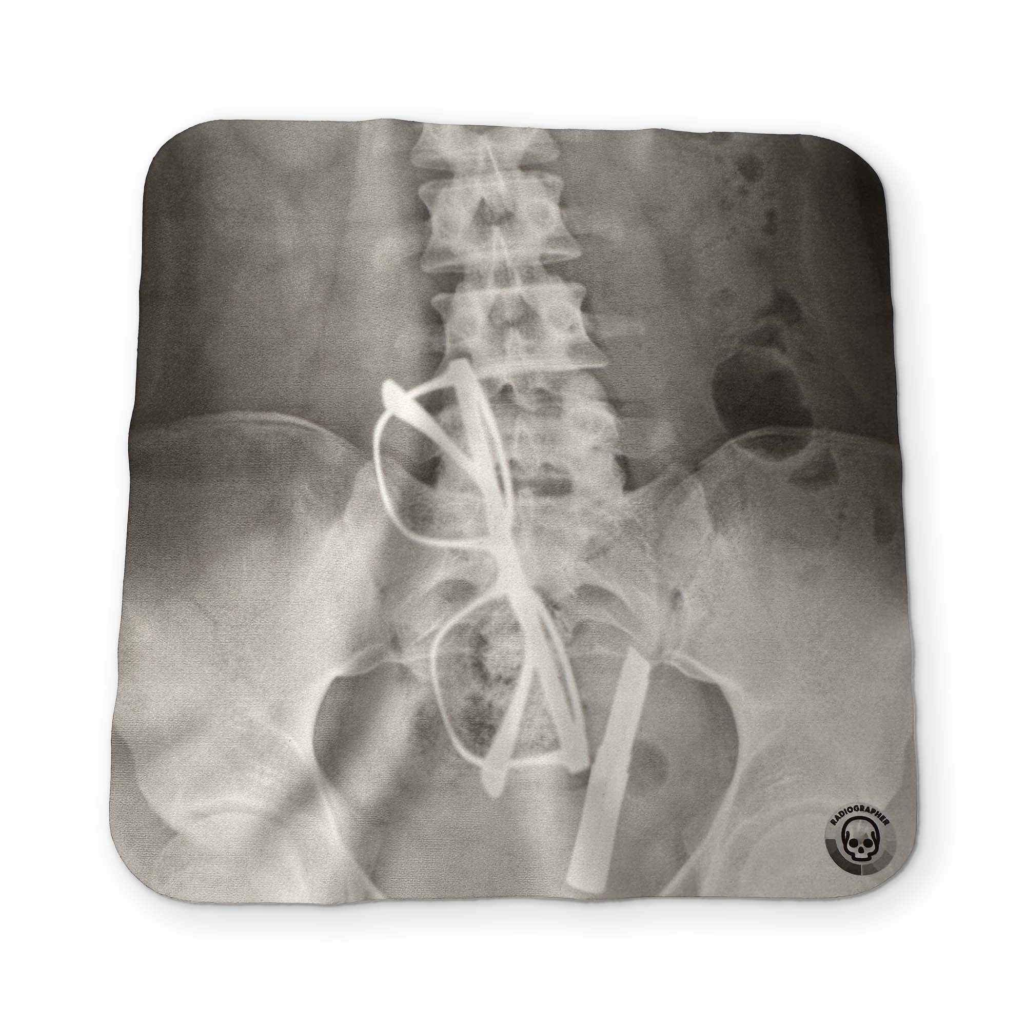 AN  X-RAY YOU CAN CLEAN YOUR GLASSES WITH