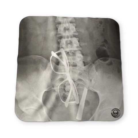 AN  X-RAY YOU CAN CLEAN YOUR GLASSES WITH