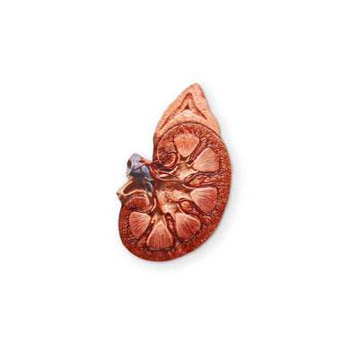 A KIDNEY YOU CAN CLEAN YOUR GLASSES WITH